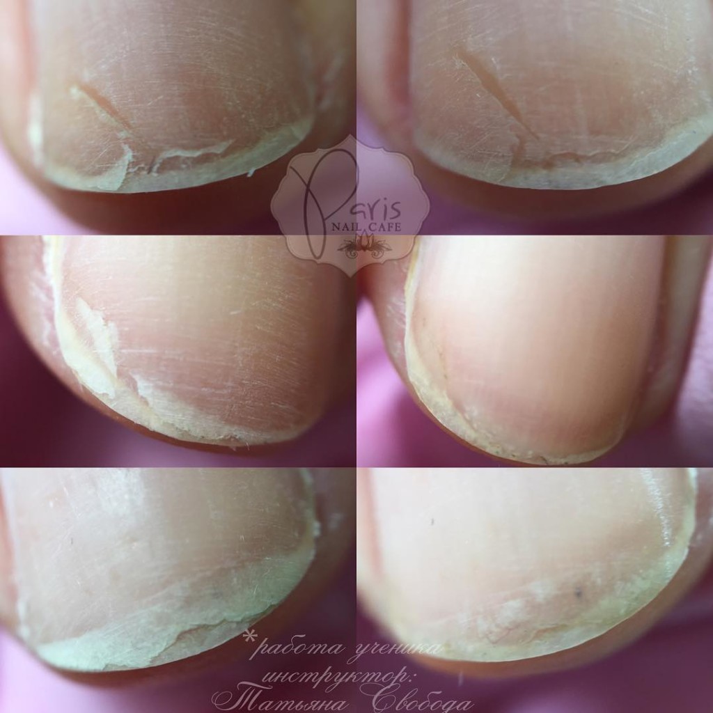 Как выглядят ногти после снятия гель лака фото